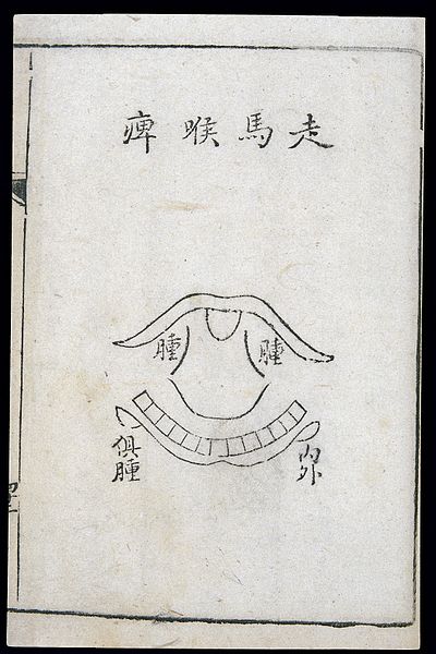 File:C18 Chinese woodcut; Galloping pharyngitis Wellcome L0039731.jpg