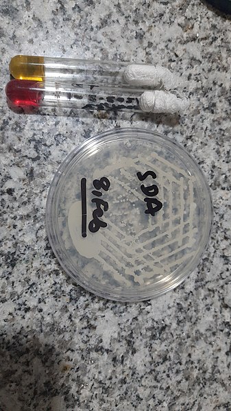 File:Cryptococcus neoformans growth on SDA and Urease test Positive.jpg