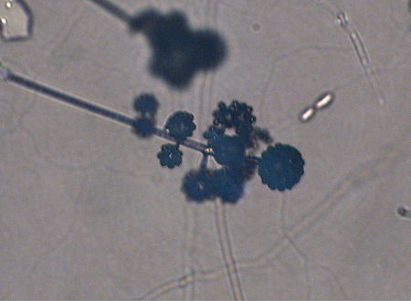 Cunninghamella echinulata01.jpg