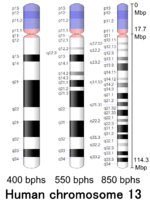 Thumbnail for Chromosoma 13 (homo)