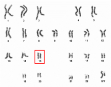 Menschliches männliches Karyotpe hochauflösend - Chromosom 15.png