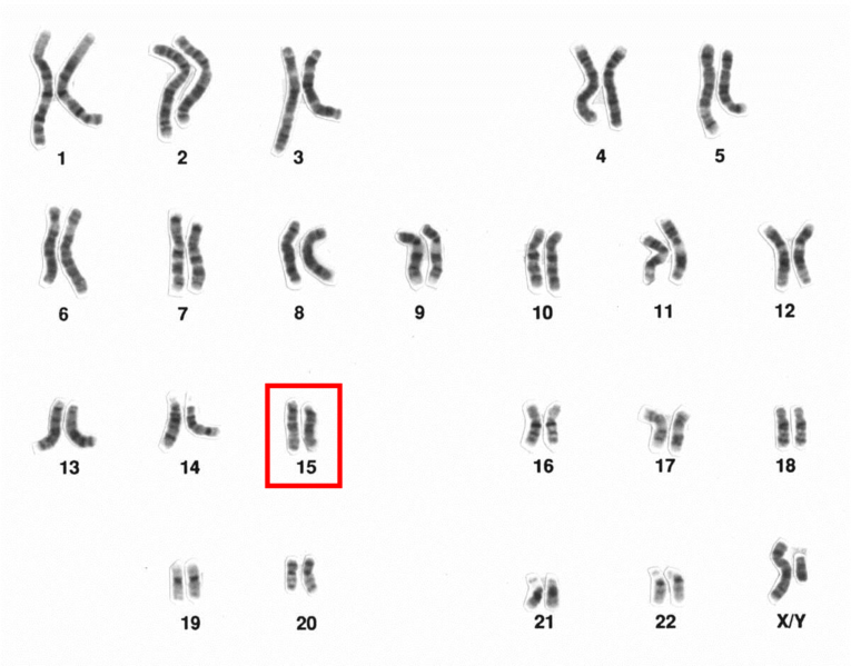 File:Human male karyotpe high resolution - Chromosome 15.png