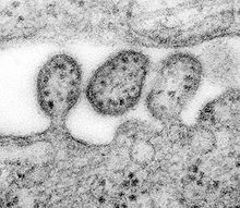 Lassa virus virions TEM 8699 lores.jpg