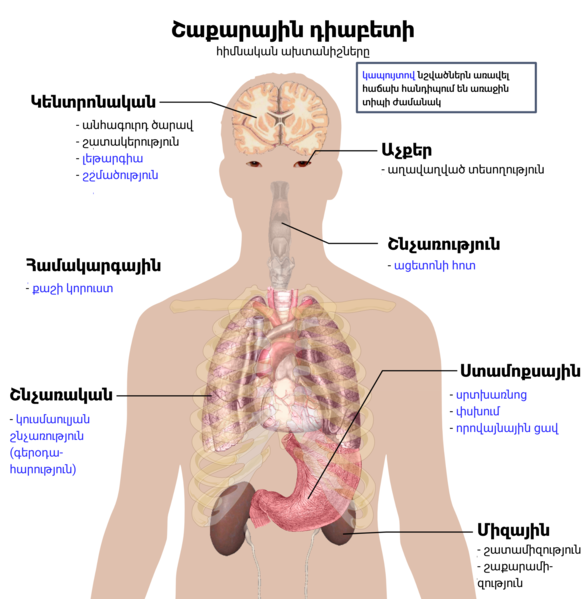 File:Main symptoms of diabetes (hy).png