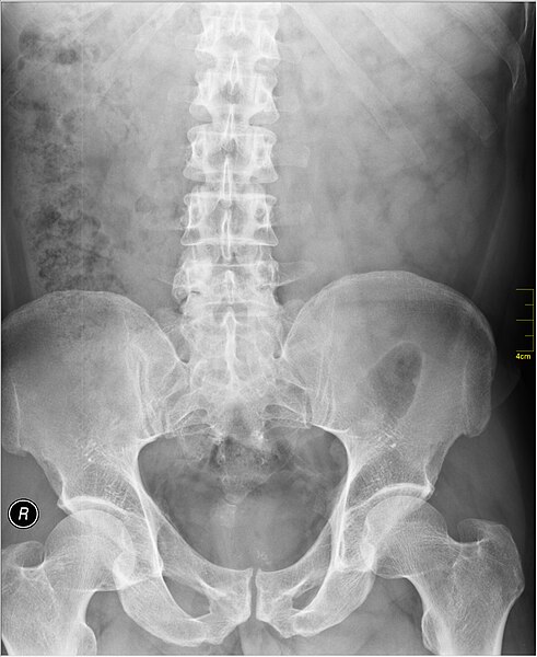 File:Medical X-Ray imaging RYF07 nevit.jpg
