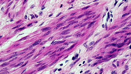 Muscle tissue is developed from the growth medium and organized in a three-dimensional structure by the scaffold for end product.