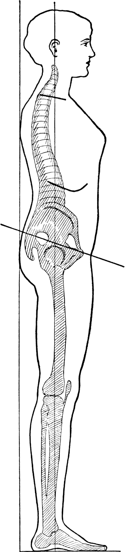 Hình thu nhỏ cho Tập tin:NormalPoise.gif