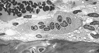 Light micrograph of an osteoclast displaying typical distinguishing characteristics: a large cell with multiple nuclei and a "foamy" cytosol. Osteoclast.jpg