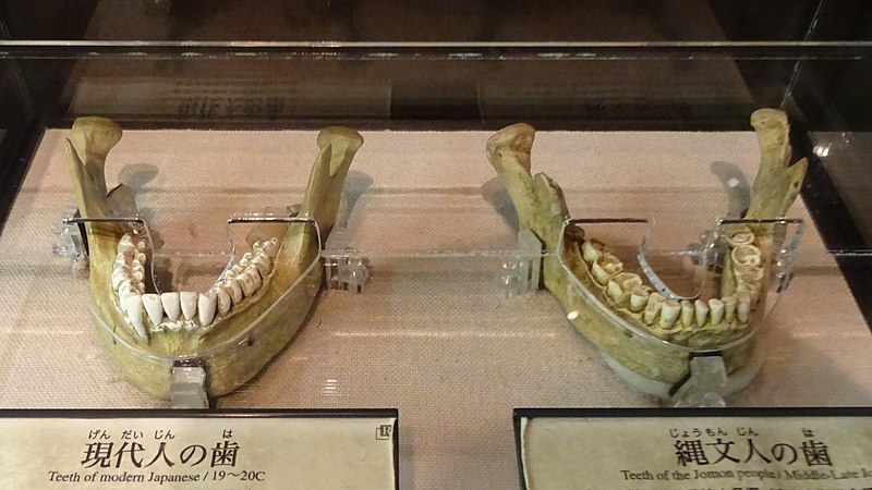 File:Teeth of modern Japanese and Teeth of the Jomon people - Niigata Prefectural Museum of History.jpg