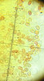 spores