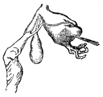 Genitalia figured in the original description Deroceras cecconii genitalia Figure 4 Pollonera 1896.png