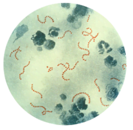 Fail:Streptococcus pyogenes 01 thumbnail.png
