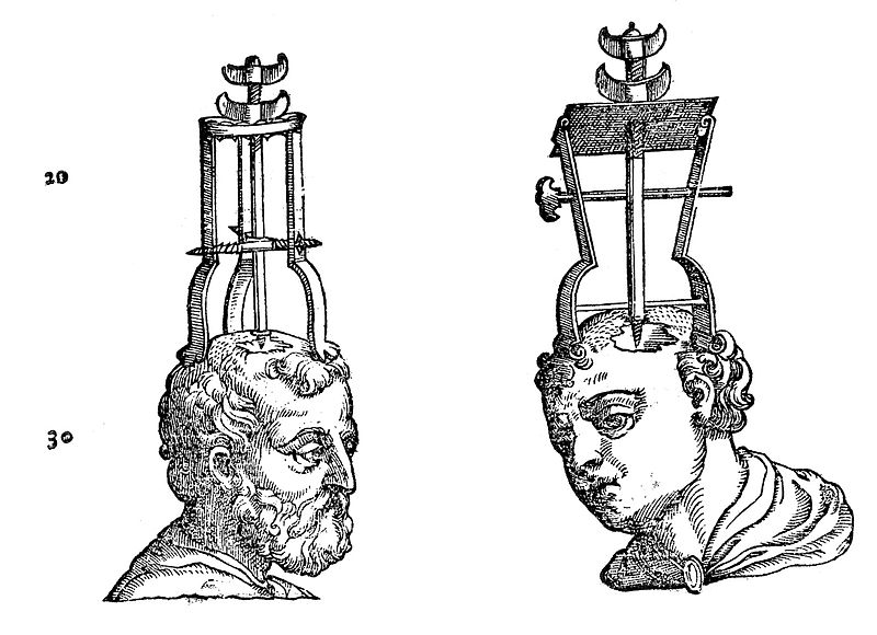 File:Trephining instruments and apparatus, 1573 Wellcome L0007377.jpg