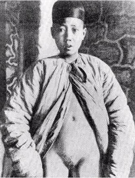 A Chinese eunuch boy in 1901 during the Qing dynasty with all his genitals removed.