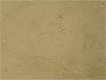 Arthrobotrys spores 160X.png