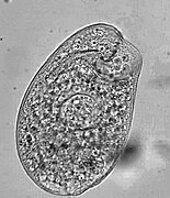 Climacostomum (Climacostomidae)