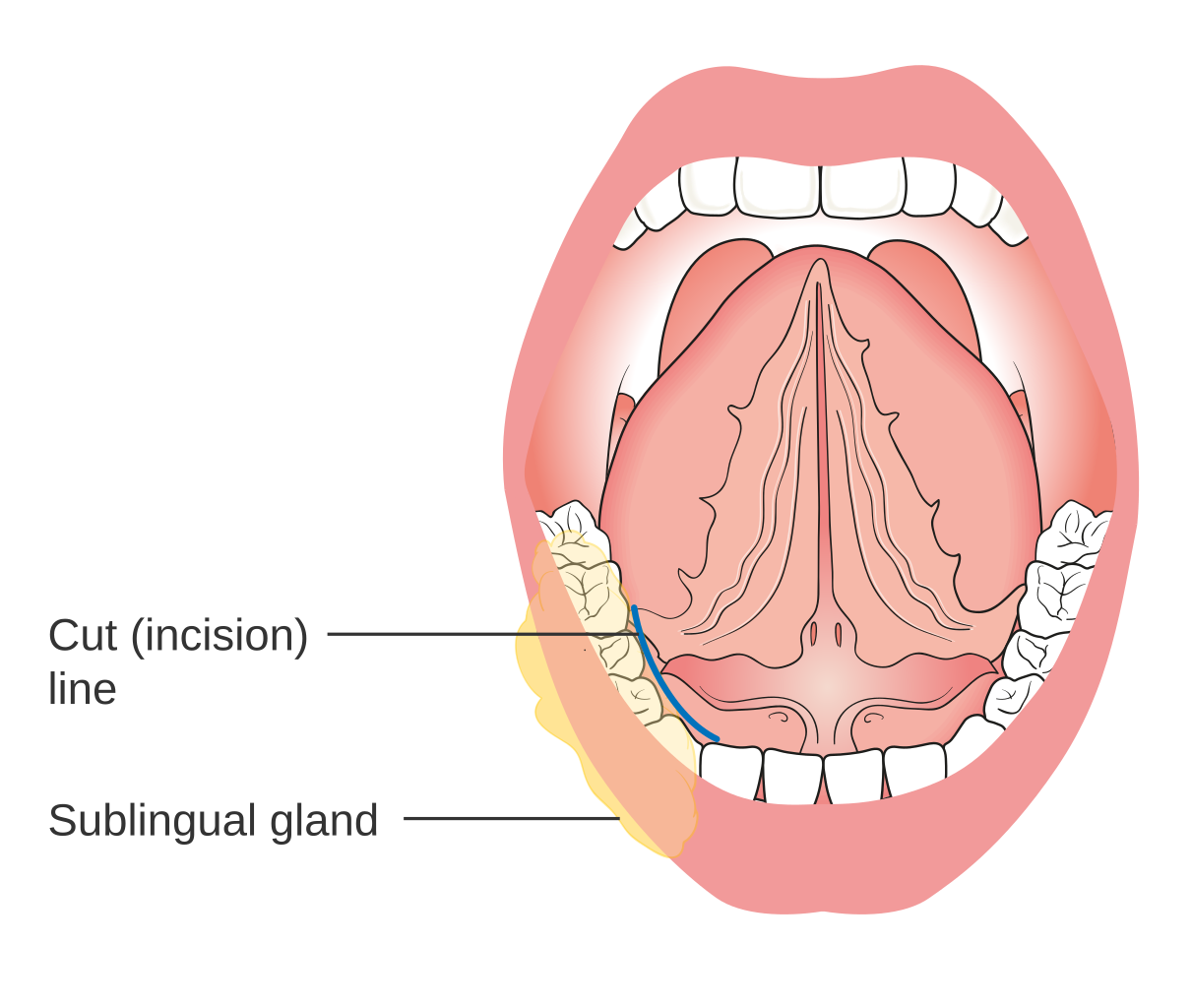 view vestibular migraine and related syndromes