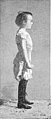 Fig. 112. Enfant de neuf ans avec un corset abdominal type Gach-Sarraute.