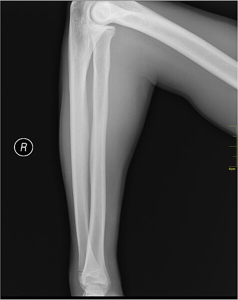 File:Medical X-Ray imaging PCQ06 nevit.jpg