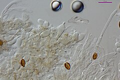 Psilocybe subaeruginosa pleurocystidia 600x