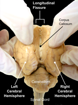 Головной мозг домашней овцы. Вид сзади. Видна продольная щель, разделяющая левое и правое большие полушария головного мозга.