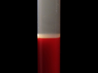 <span class="mw-page-title-main">Buffy coat</span> Blood component after centrifugation