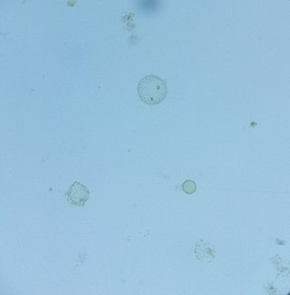 <i>Volvox globator</i> Species of alga