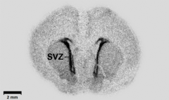 In an embryonic rat brain, GAD67-binding marker tends to concentrate in subventricular zone. An image from Popp et al., 2009. Autoradiography of a brain slice from an embryonal rat - PMID19190758 PLoS 0004371.png