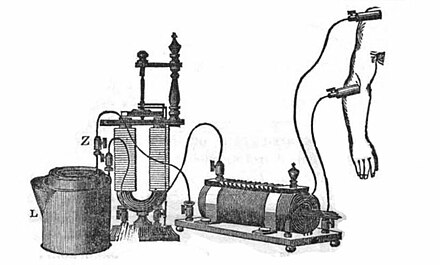 Davis's electrical shock device for the body