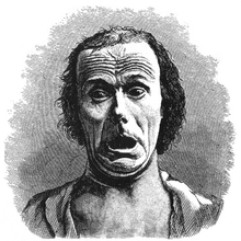 Wide eyes and raised eyebrows are common indicators of surprise (Figure 20 from Charles Darwin's The Expression of the Emotions in Man and Animals) Expression of the Emotions Figure 20.png