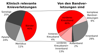 Kreuzbandriss: Arten, Verletzungsmechanismen, Häufigkeit