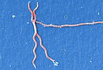 Thumbnail for File:Lyme disease parasite Borrelia burgdorferi.jpg