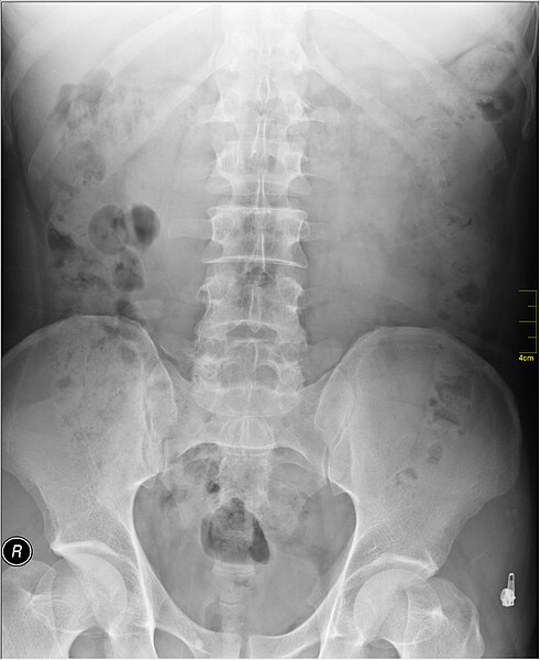 File:Medical X-Ray imaging CPQ03 nevit.jpg