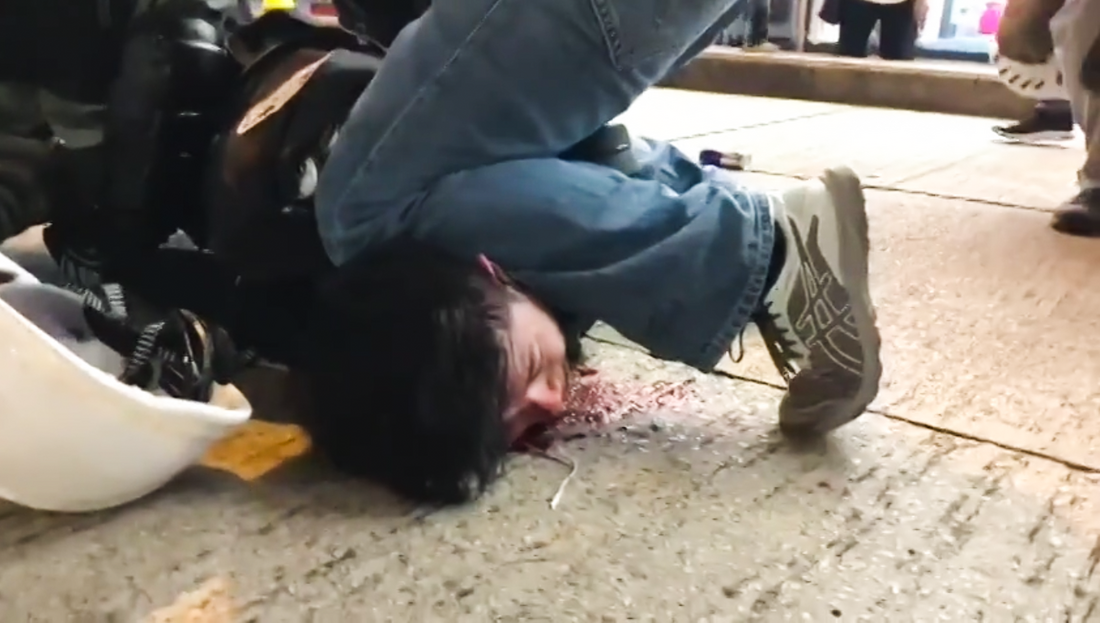 File:Protester injured and feel pain after arrested in CWB 20190811.png