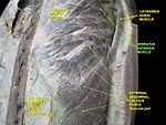 Serratus anterior muscle. Anterior thoracic wall. External abdominal oblique muscle. Deep dissection, anterior view.