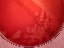 b-hemolytic colonies of Streptococcus agalactiae, blood agar 18h at 36degC Streptococcus agalactiae on blood agar.JPG