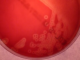 β-hemolytic colonies of Streptococcus agalactiae, blood agar 18h at 36°C