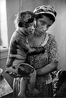 Wounded child in 1st Chechen war