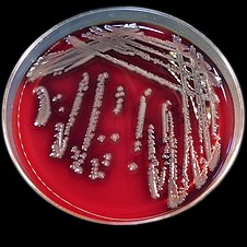 Aeromonas hydrophila colonies on the blood agar. Aeromonas hydrophila colonies 01.jpg