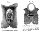 Miniatura para Septo vaginal