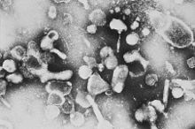 Electron micrograph of "Feline leukemia virus"