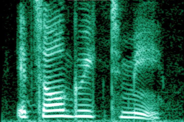 The spectrogram of the human voice reveals its rich harmonic content.