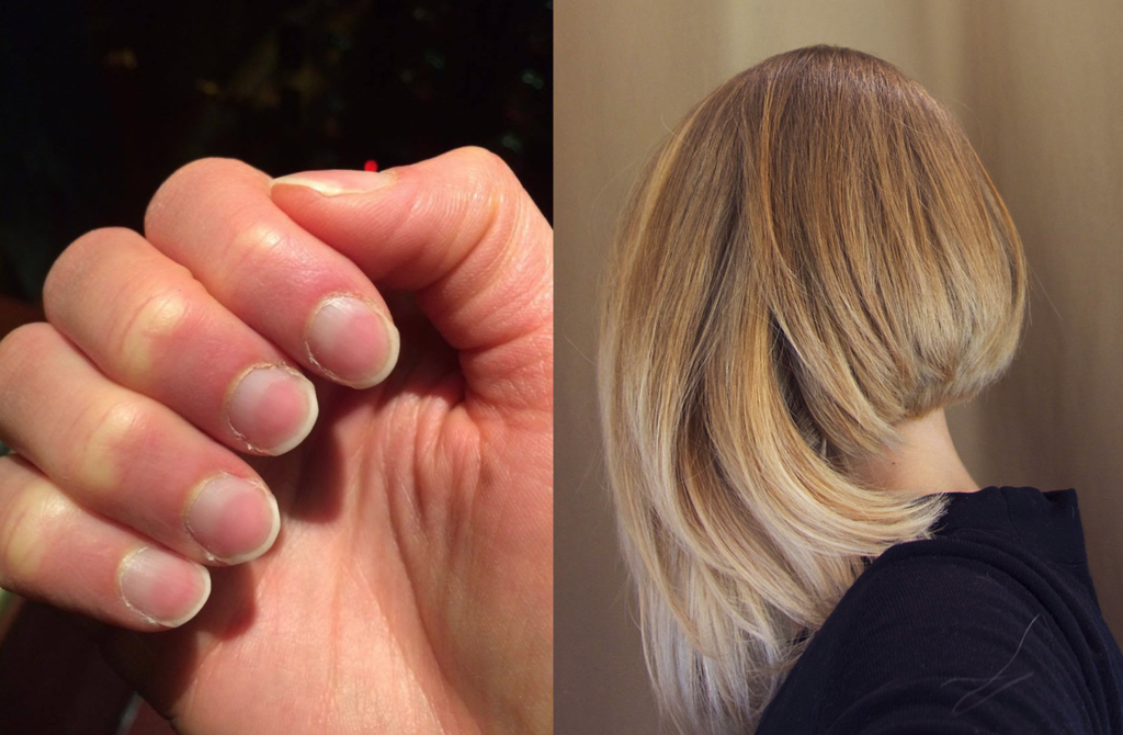 1024px Nail and Hair Growth