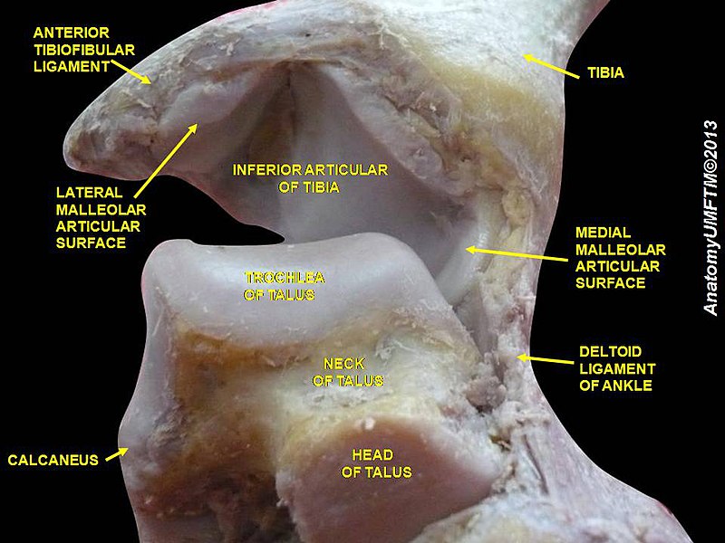 File:Slide8CEC7.JPG