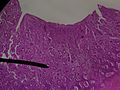 子宫内膜的显微照片