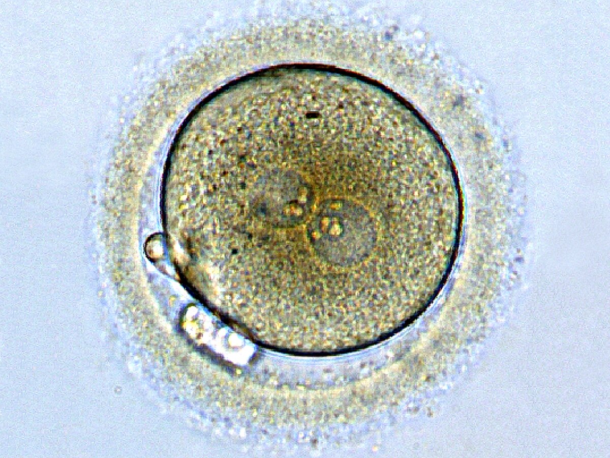 Zygote - Wikipedia