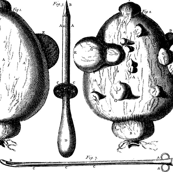 File:A general system of surgery Fleuron N002403-22.png