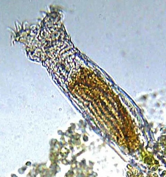 File:Bdelloid Rotifer (cropped).jpg