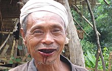 The stained teeth of a regular betel chewer in Burma Betel.jpg