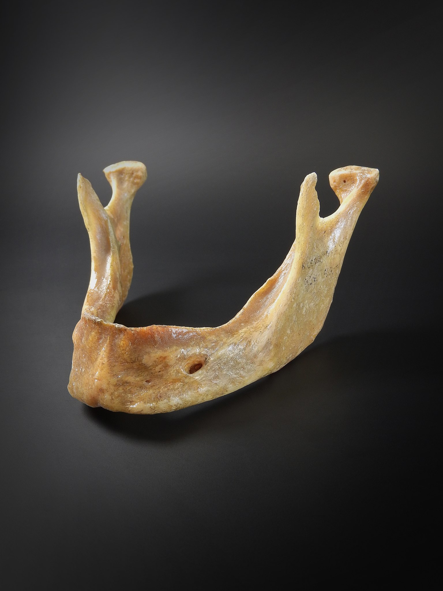 File:Apatinis žandikaulis, mandibula.jpg - Wikimedia Commons